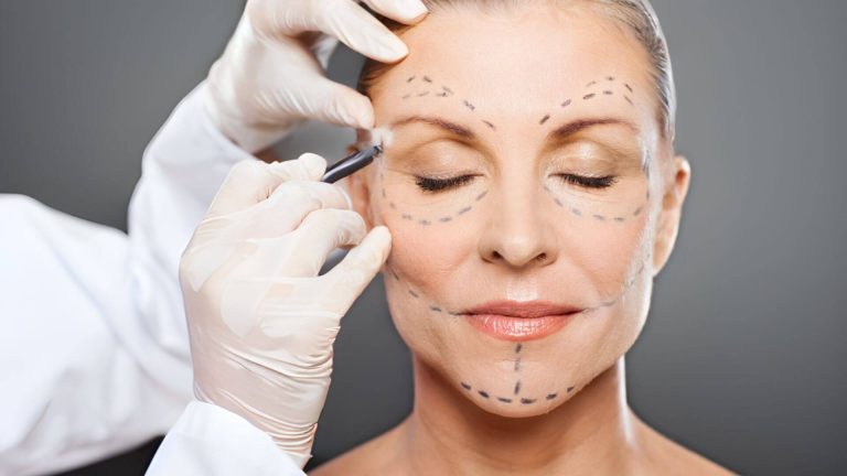 Como é feita a blefaroplastia